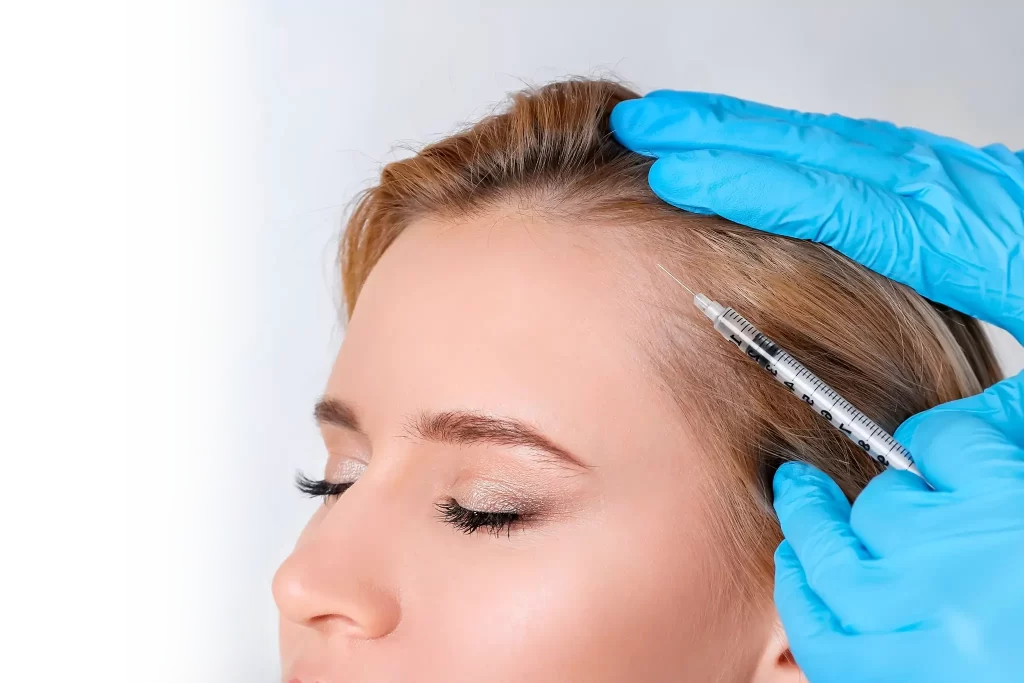 mesoterapia capilar