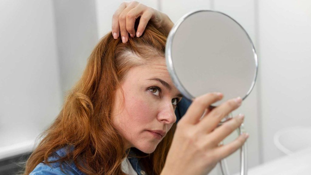 Caída de pelo por estrés en mujeres Caída de pelo por estrés en mujeres