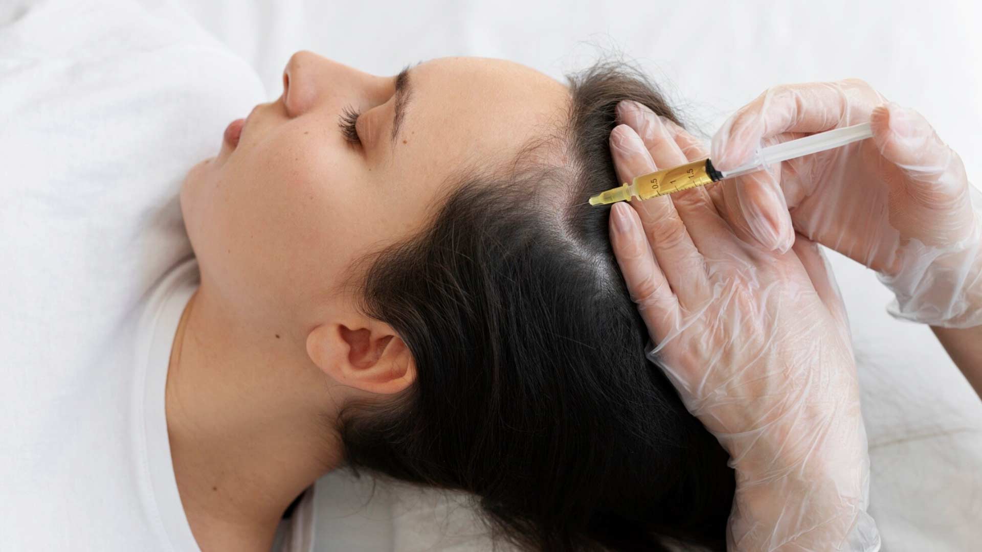 ¿Cómo hacer crecer el pelo rápido? prp-o-mesoterapia-capilar-qué-es-mejor