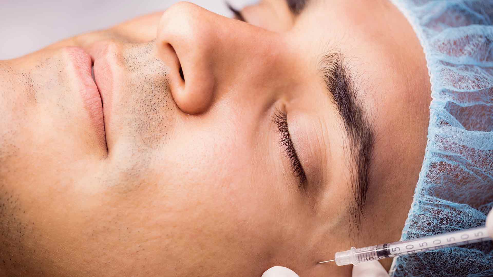 rendensificación-facial-con-ácido-hialurónico rendensificación-facial-con-ácido-hialurónico