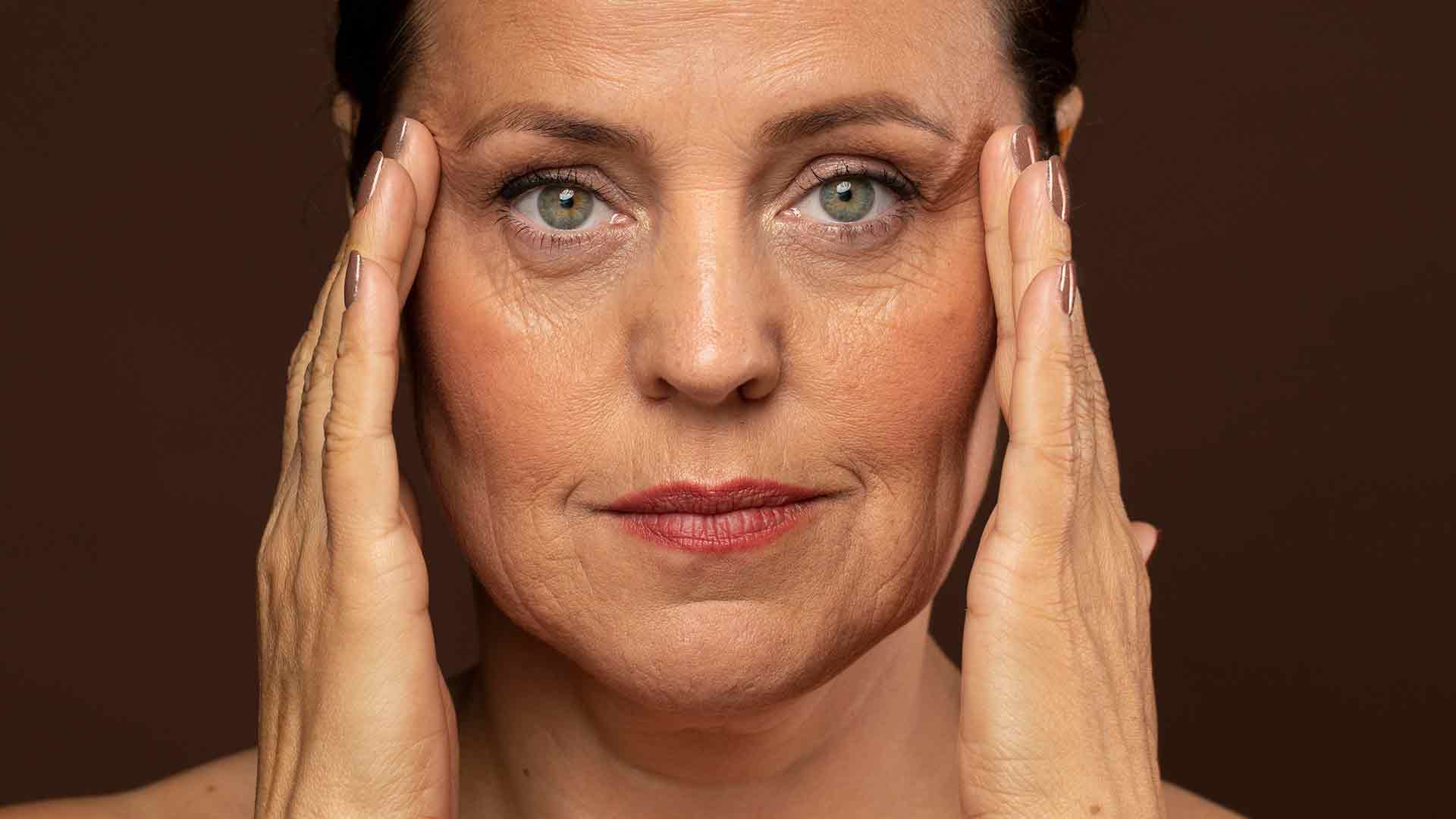 Bótox o ácido hialurónico ¿por-qué-tengo-tantas-arrugas? Bótox o ácido hialurónico