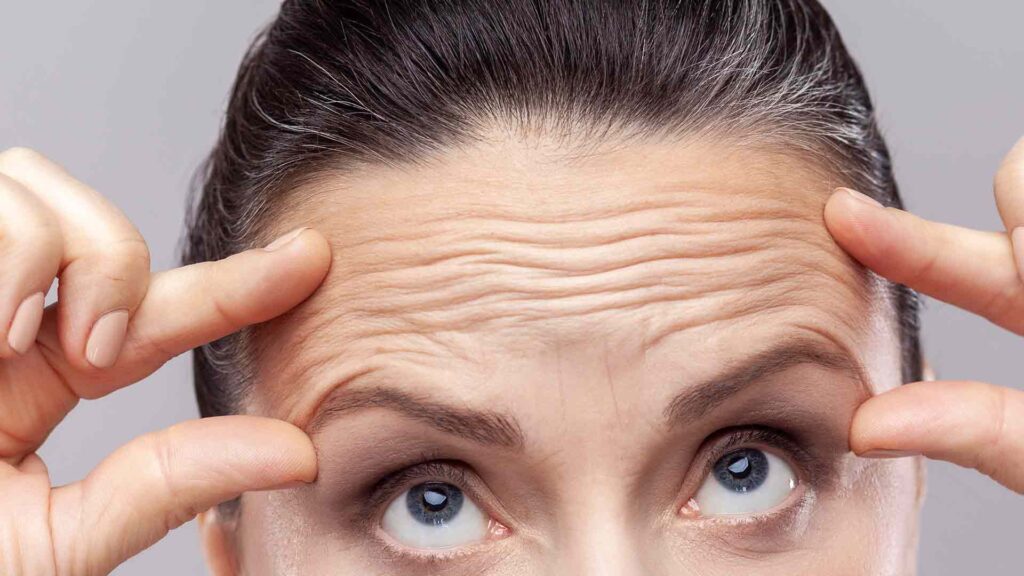 Mejores-tratamientos-faciales-para-las-arrugas-en-la-frente