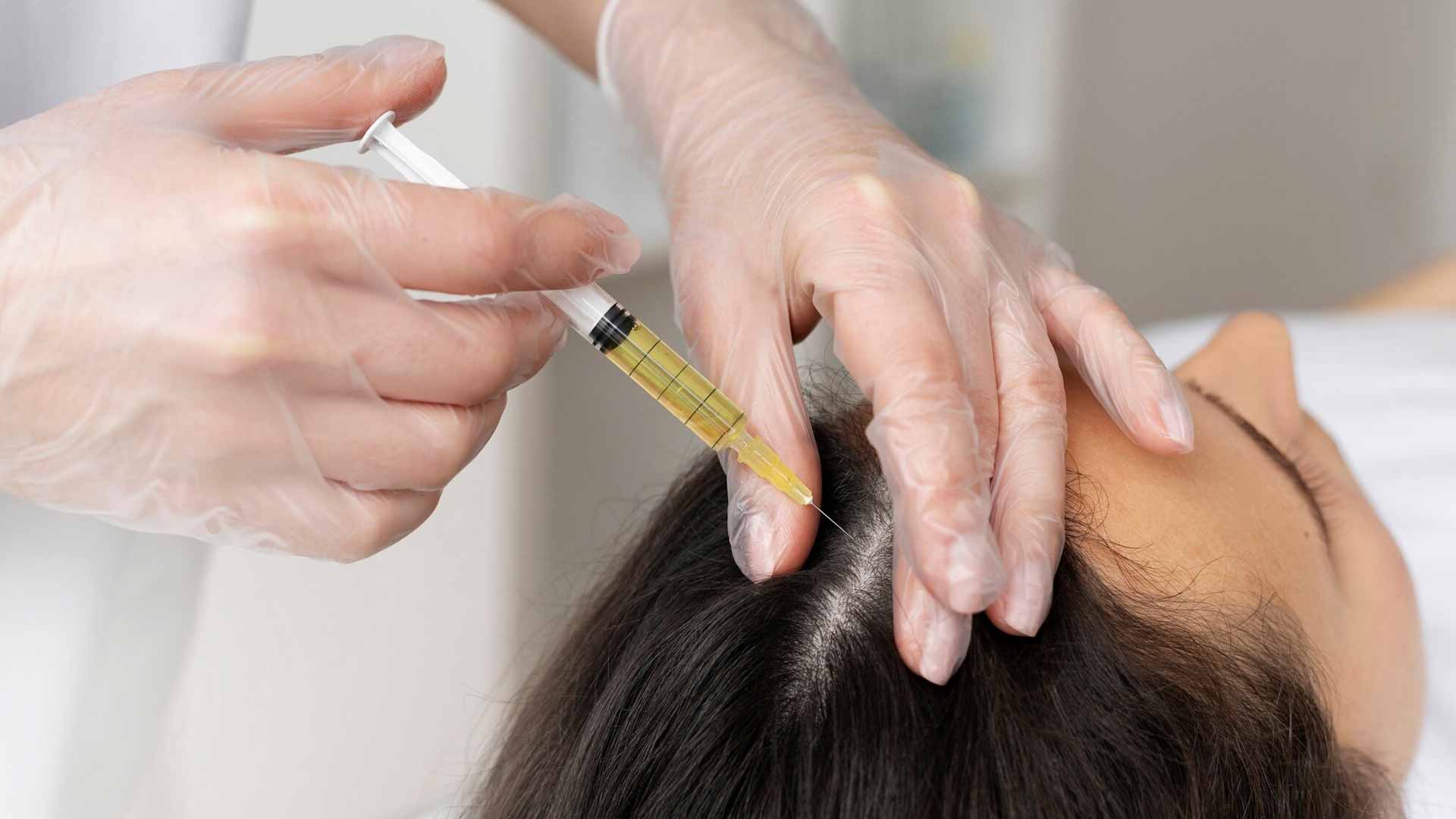 como frenar la alopecia como-mantener-una-buena-salud-capilar