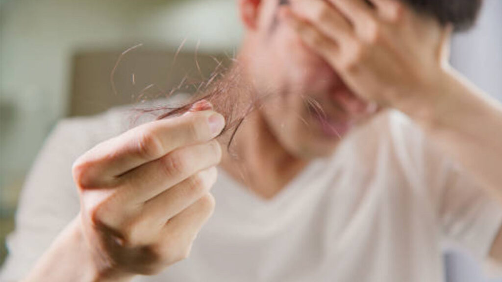 como-frenar-la-alopecia