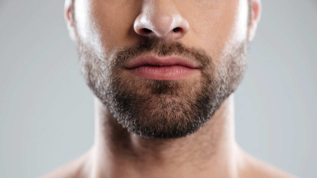 huecos-en-la-barba
