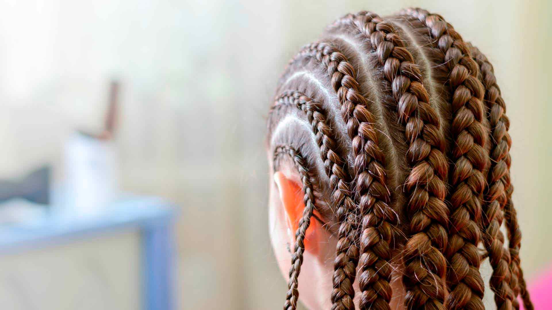 alopecia-por-tracción-o-alopecia-traccional