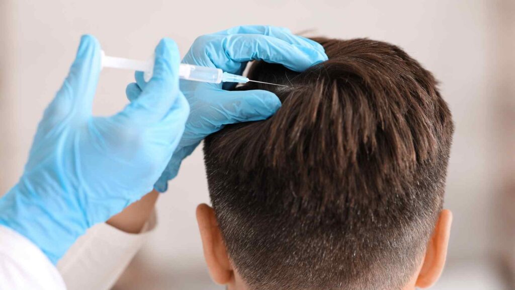 bioestimulación capilar con prp