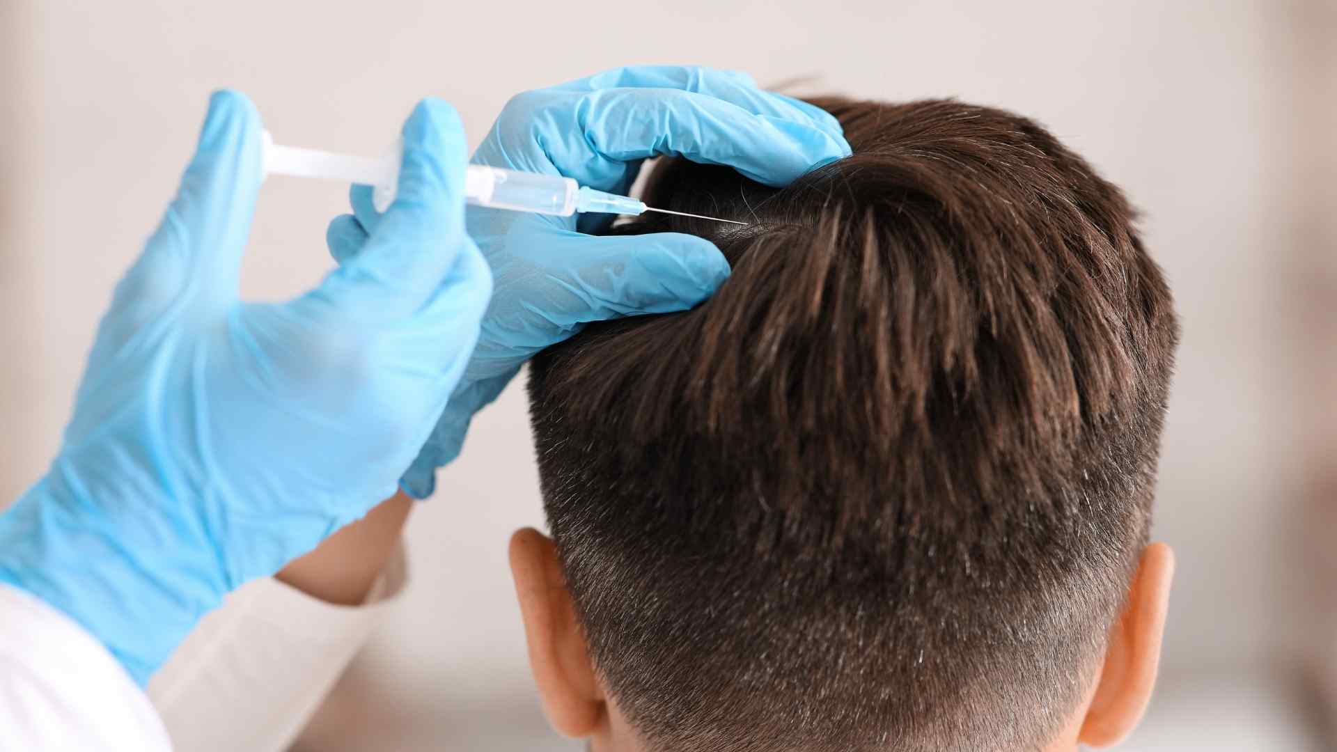 Bioestimulación capilar - Clínica Capilar Pivaz