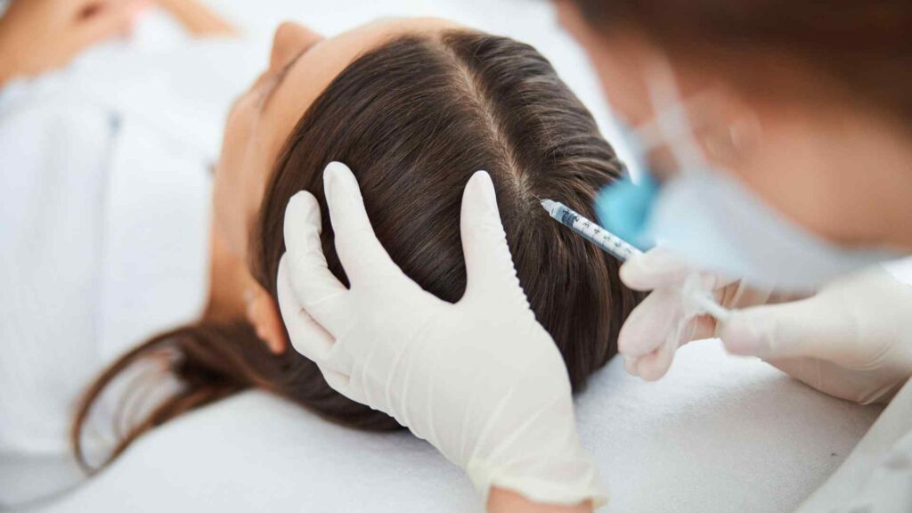 Mesoterapia capilar o PRP