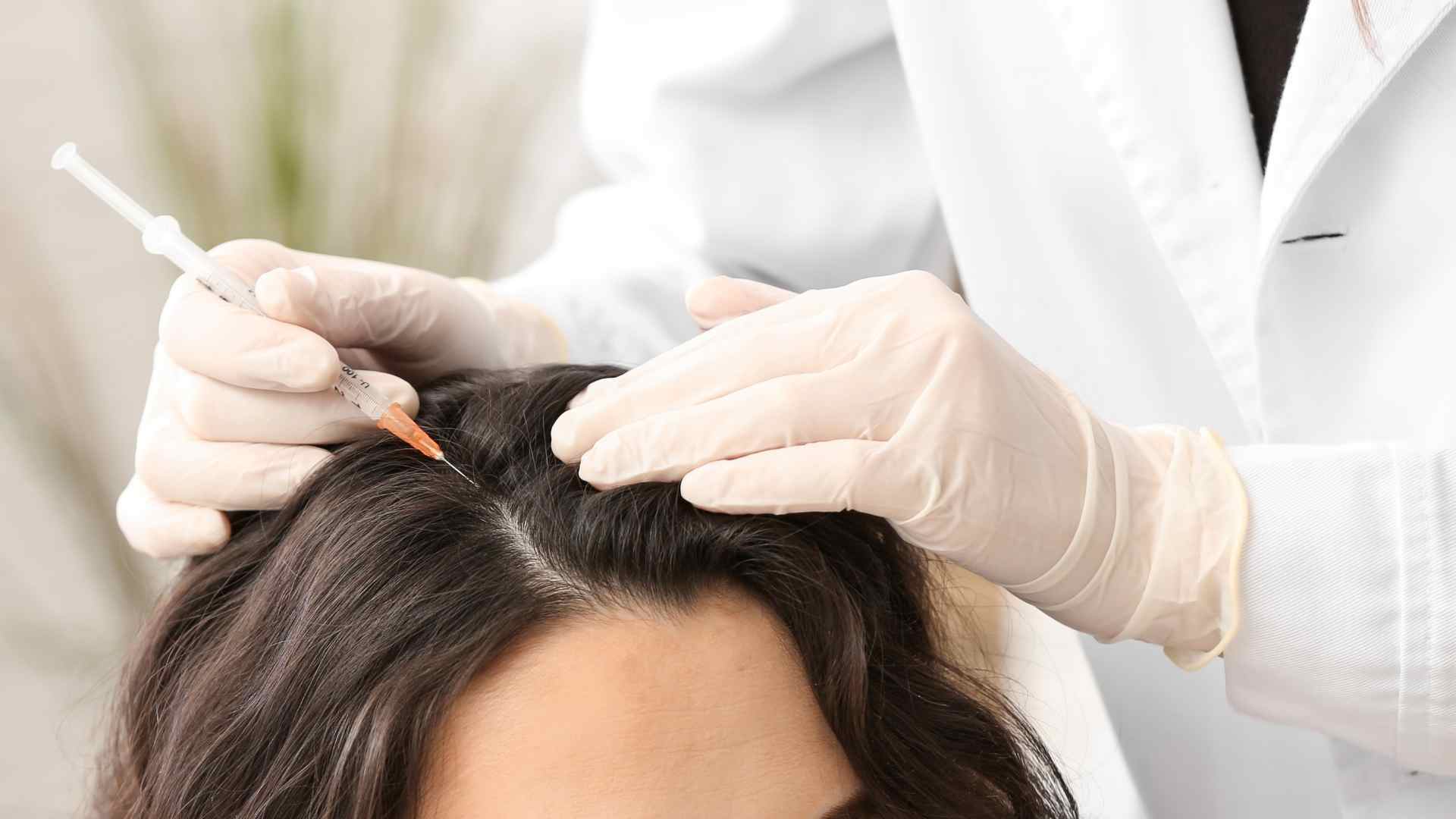 Injertos de pelo en mujeres y prp capilar mujer Injertos de pelo en mujeres y prp capilar mujer