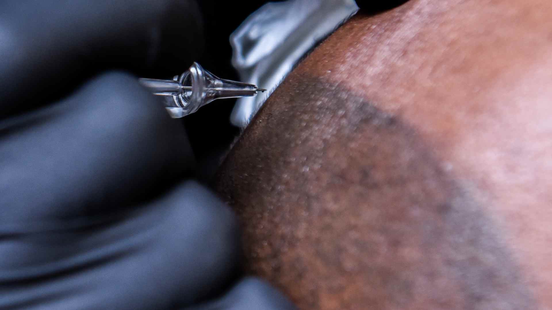 Micropigmentación o injerto capilar Micropigmentación o injerto capilar