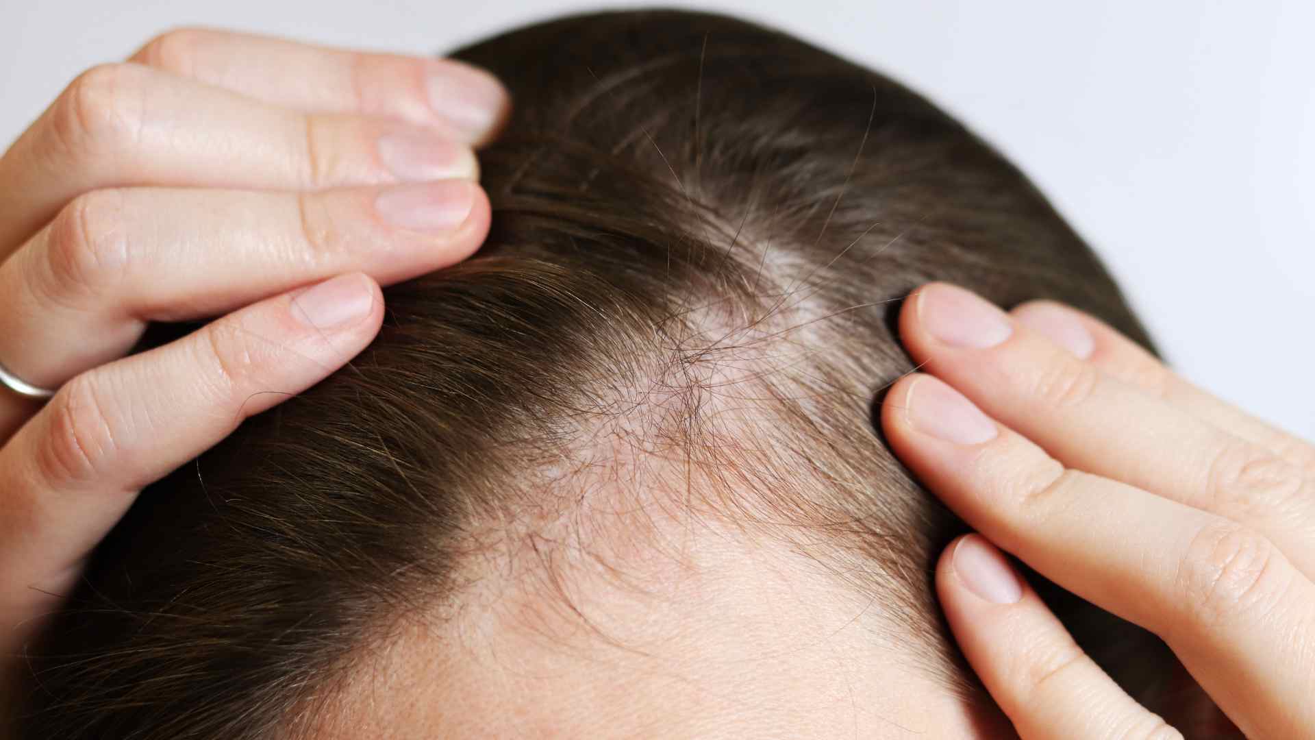 caída pelo mujer caída pelo mujer