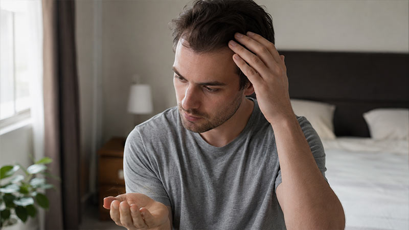 Alopecia androgenética en hombres jóvenes