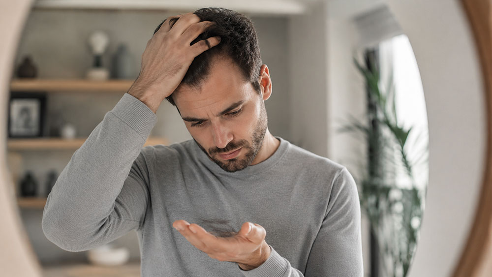 caida del pelo por estres o genetica