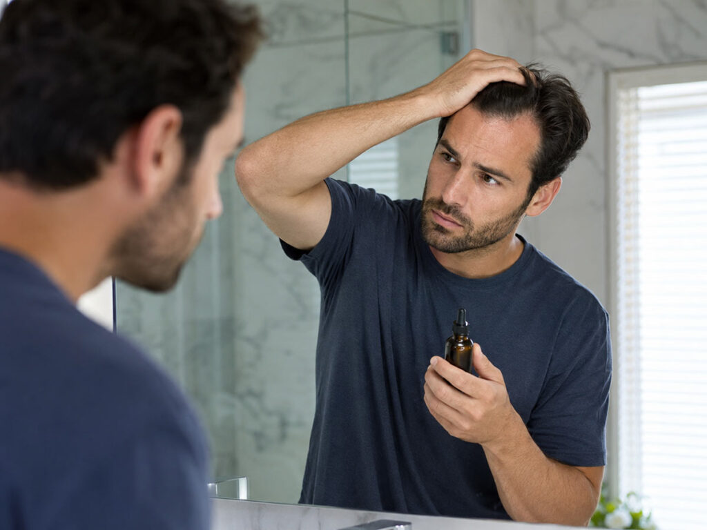 Minoxidil caida pelo